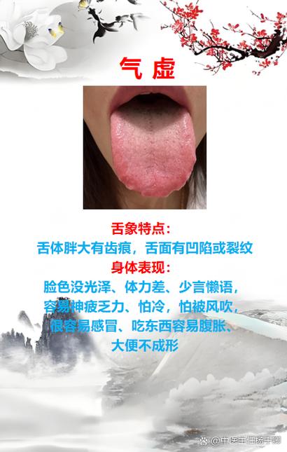 舌頭長痣的女人是富貴命嗎