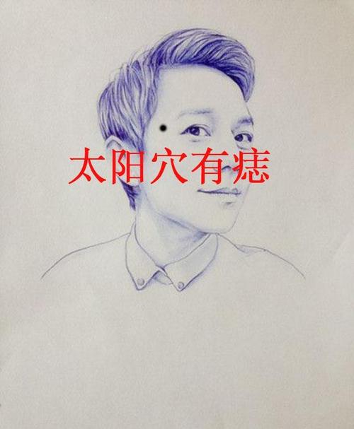 男人太陽穴有痣