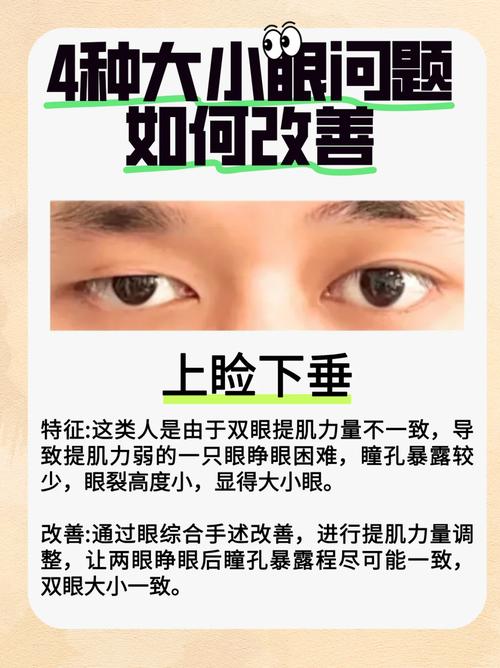 男人眼睛一大一小如何 好不好