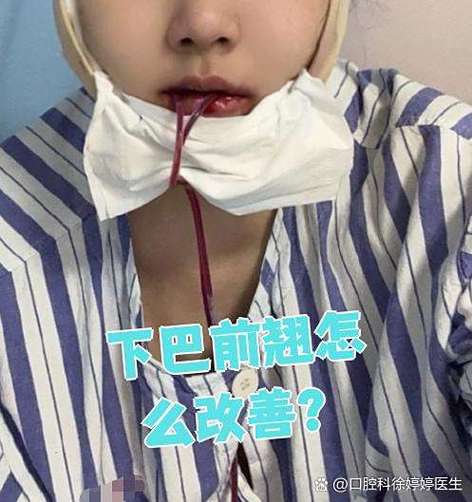 下巴尖端往上翹 下巴朝前好不好