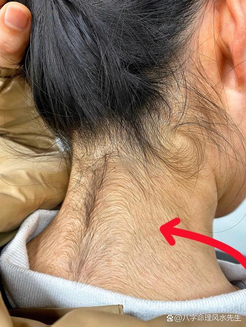 頭發(fā)長到脖子后命運