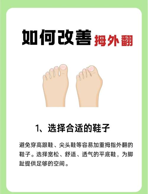 腳趾外翻的女人命苦嗎 命苦的腳型有哪些