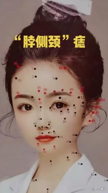 女人痣相脖子有痣是富貴命嗎