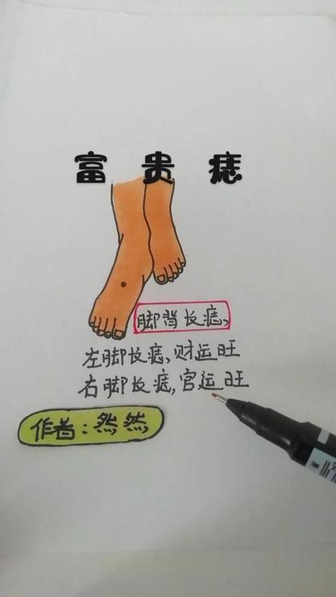 腳背長痣代表什么