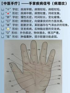 掌中的字形紋代表著什么