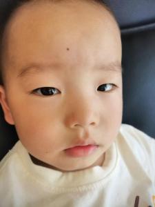 小孩鼻尖有痣是福相嗎