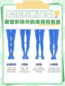 從一個人的腿型能預(yù)知健康情況嗎