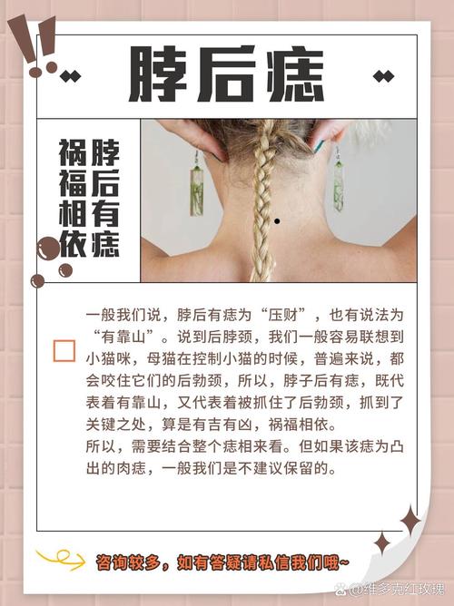 后脖子有痣圖解命運如何
