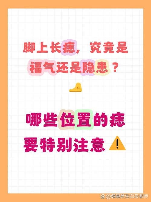 腳背有痣一定是苦命嗎 如何化解