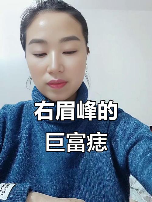 痣在右眉頭