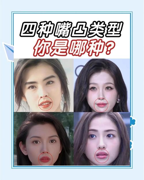 女人嘴凸的面相好嗎 有什么影響