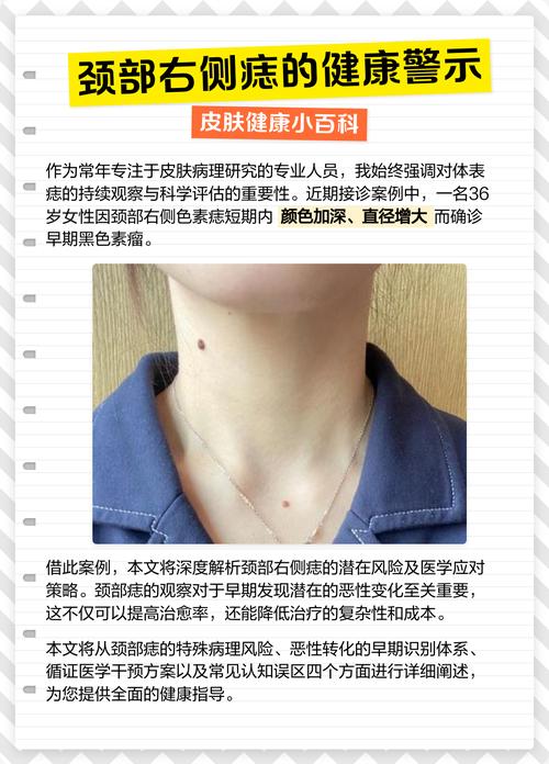 男人右頸有痣