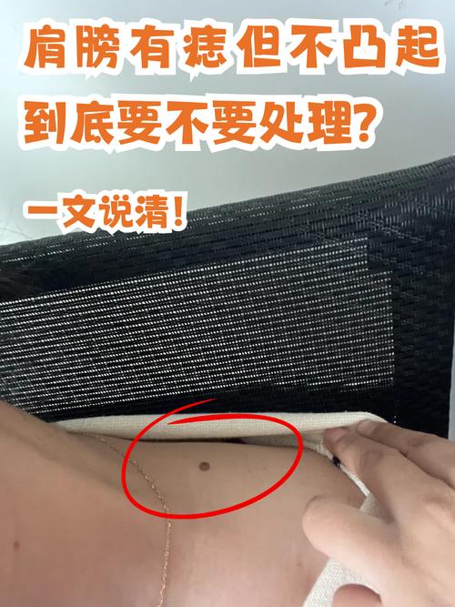 男人右肩膀上有痣代表什么
